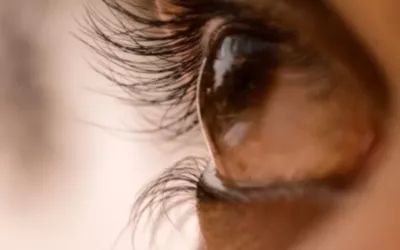 astigmatism-eye