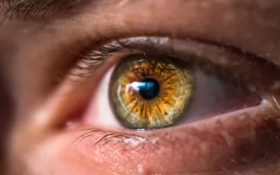 eyelid surgery