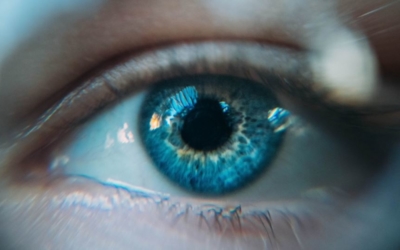 glaucoma eye