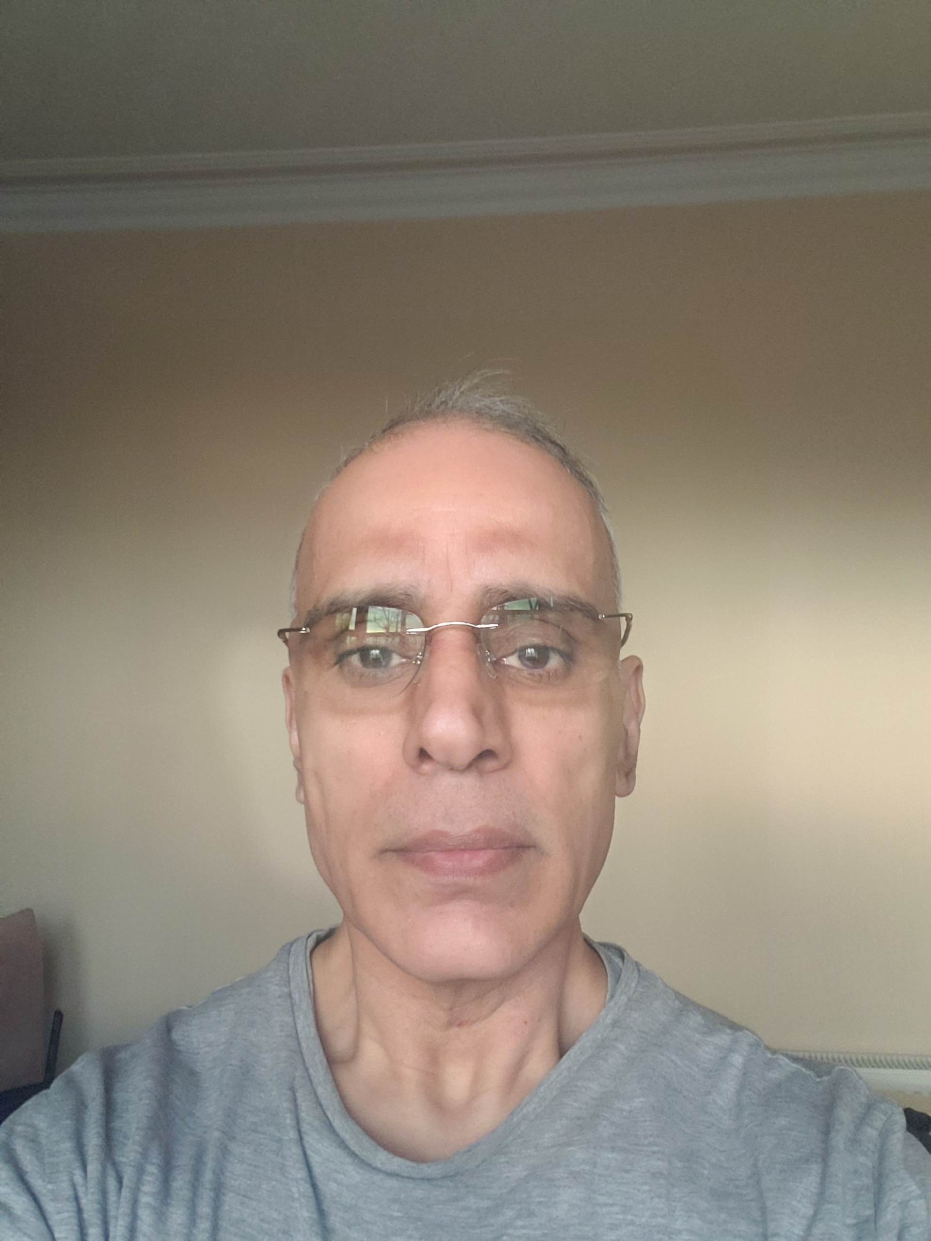 Eye Surgery Gives Birmingham Resident A Fresh Focus On Life Optegra eye-surgery-gives-birmingham-resident-a-fresh-focus-on-life-optegra