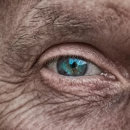 old age cataract